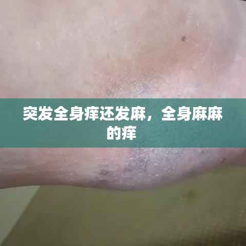 突发全身痒还发麻，全身麻麻的痒 