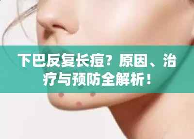 下巴反复长痘?原因、治疗与预防全解析!